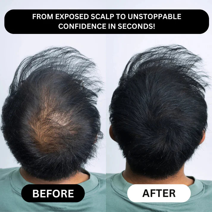 Densifyer™ Hairline Density Filler