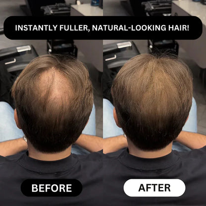 Densifyer™ Hairline Density Filler