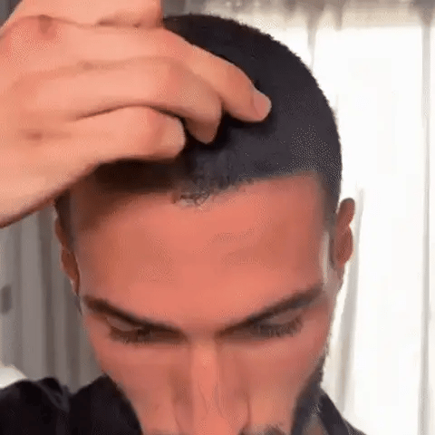 Densifyer™ Hairline Density Filler