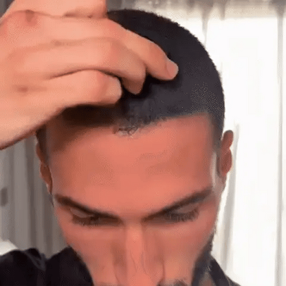 Densifyer™ Hairline Density Filler